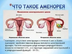 Что может служить причиной задержки менструации у девственницы?