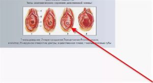 Больно ли лишаться девственности во время месячных?