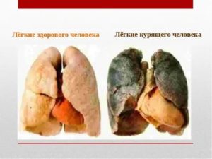 Определит ли врач курящего человека?