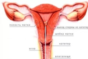 Можно ли забеременеть, если проглотить сперму?