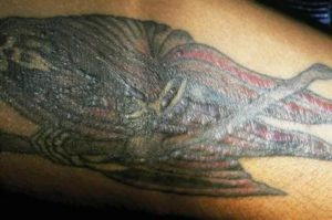 Сыпь с зудом на татуировке