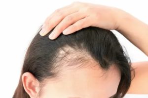 Запоры, выпадение волос