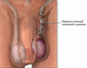 Шишка на половом члене