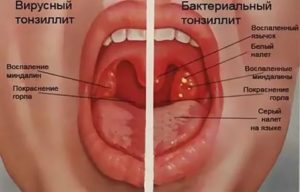 Шипит в горле,  к какому врачу обращаться с такой проблемой?