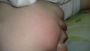 У ребёнка 3 лет шершавые щечки