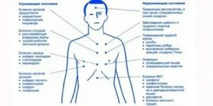 Жжение в области солнечного сплетения