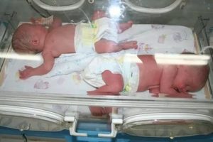На каком сроке рождается двойня, и какой вес характерен?