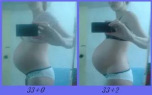 Болит живот и поясница, 34 неделя беременности
