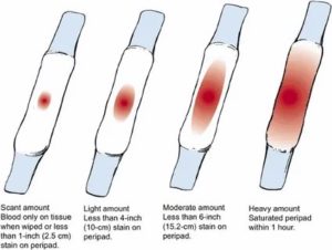 После ПА пошла кровь