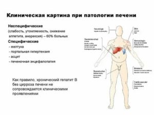 Болит печень при нажатии на неё и наклонах