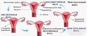 Болезненная менструация после задержки