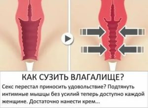 Как можно сузить влагалище после родов?