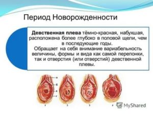 У меня уже нет девственной плевы?