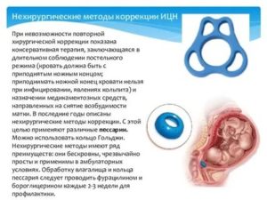 Запоры при ИЦН, посоветуйте что-нибудь, пожалуйста