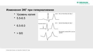 Плановое ЭКГ при ОРВИ