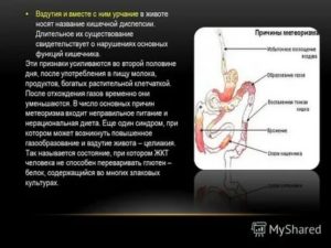 Постоянное вздутие и урчание в животе