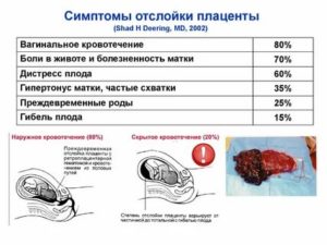 Какие лекарства назначают при отслойке плаценты?