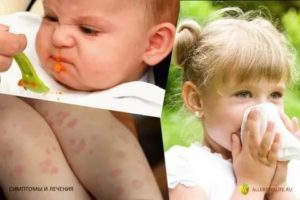 У ребенка заложен нос, может ли быть аллергия на мышей?