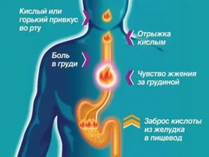 Отрыжка с привкусом крови