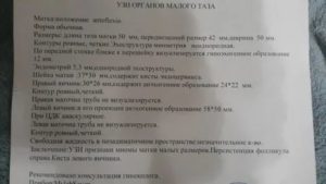 Можно ли делать УЗИ малого таза на 15 день цикла?