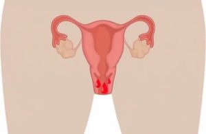Морально не готова к ежемесячным менструациям