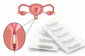 Можно ли ставить утрожестан вагинально во время месячных?