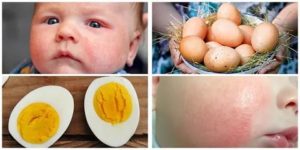 Всегда ли аллергия на куриные яйца сопровождается аллергией на курицу?