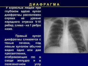 Что значит купол диафрагмы на уровне 5 ребра?