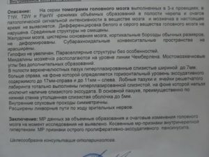 Расхождение в описании МРТ и РЭГ