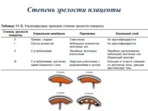 Для 30-31 недели II степень зрелости - это норма?