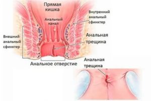 Болит между влагалищем и анусом