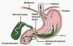 Высокая температура, рвота желчью