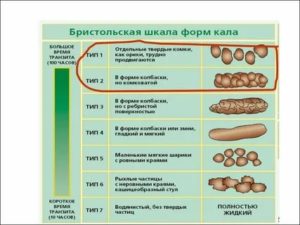 Четвёртый день беспокоит запор