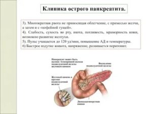 Была рвота, держится температура, сухость во рту