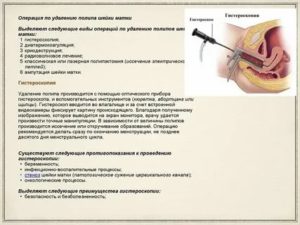 Можно ли избавиться от полипа в матке с помощью курса дюфастона?