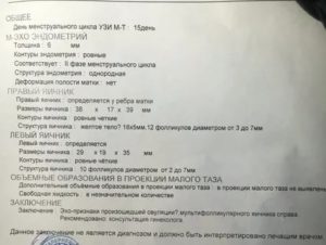 Можно ли делать УЗИ малого таза на 15 день цикла?