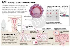 Лечит ли кольпоцид ВПЧ?
