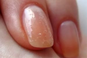 Дополнение к вопросу о пузырьках под ногтями после гель-лака