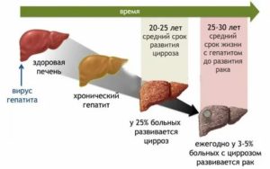 Болит печень, сердце, хочу проверить на цирроз и гепатоз