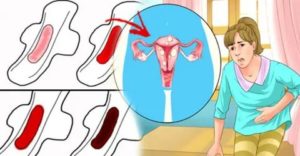 Странная менструация