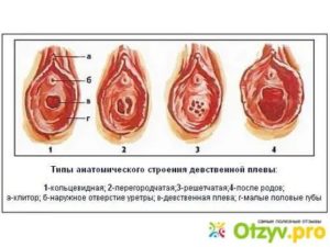 Больно ли лишаться девственности во время месячных?