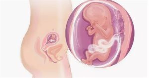 Токсикоз на 15 неделе беременности