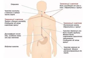 Беспокоит боль в спине в районе лопаток, изжога и отрыжка