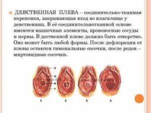 Можно ли порвать девственную плеву пальцем?