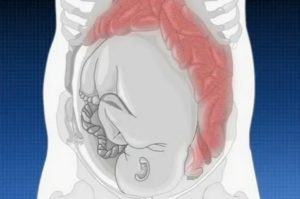 Проблемы с кишечником при беременности