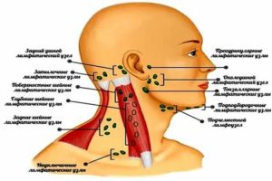 Можно ли греть лимфоузлы на шее?