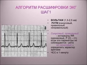 Расшифровка ЭКГ