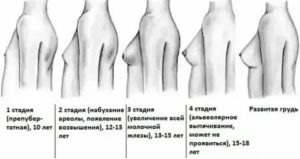 Почему в 14 лет не растёт грудь?