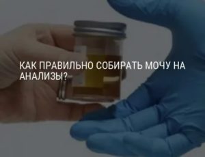 Сбор анализа мочи у лежачей больной