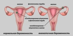 Месячные идут 2 раз с перерывом в неделю